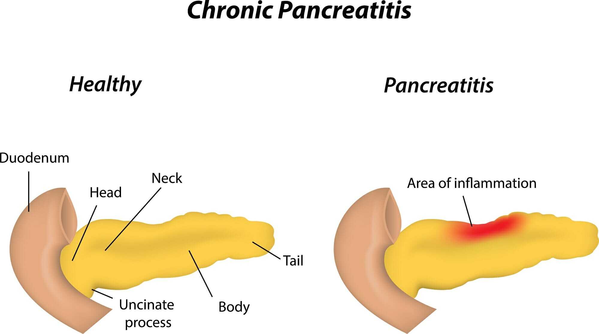 symptoms-of-appendicitis-when-to-seek-emergency-care-elite-care-24