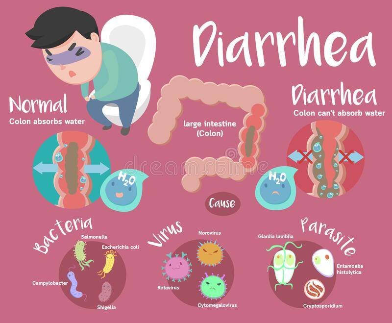 how-to-get-rid-of-diarrhea-in-5-minutes-youtube