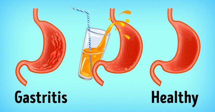 the-gastritis-would-be-better-treated-with-antibiotics-reviews