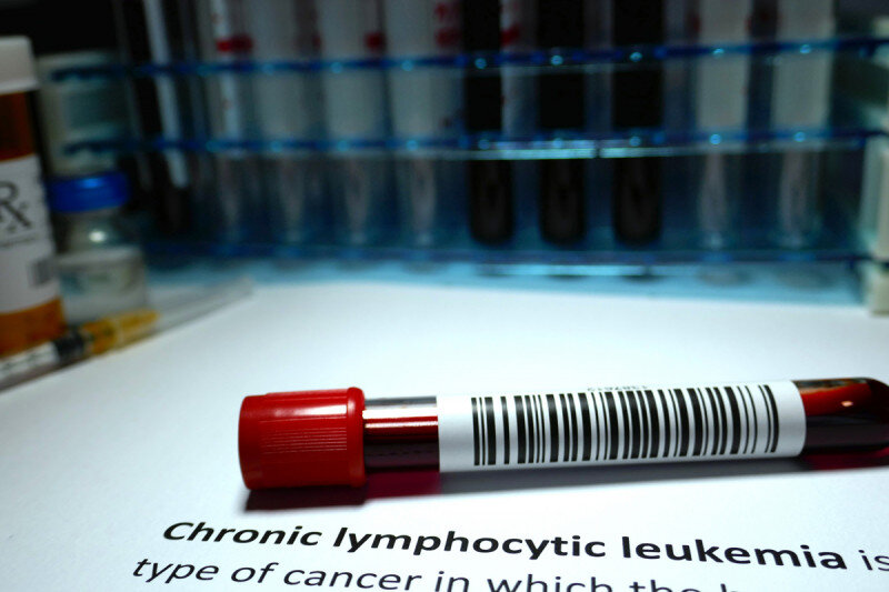 Chronic Lymphocytic Leukemia: Current Therapies - Antineoplastic agents