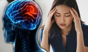 Zomig: Once-a-day Pill Could Make You Migraine Free