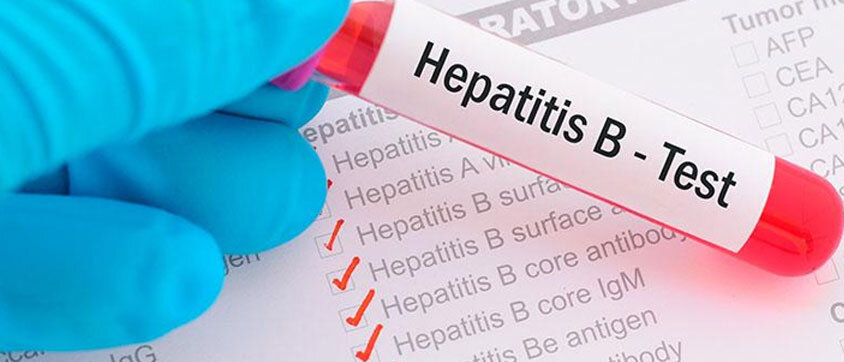 Hepatitis B - Viral Hepatitis - PocketDrugGuide